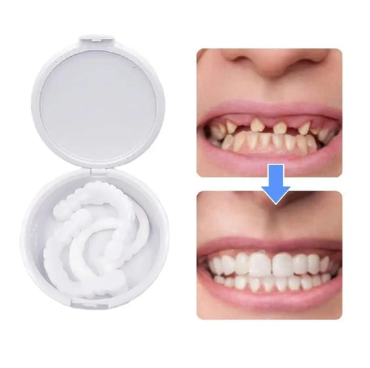Instant Smile – Fațete Dentare Reutilizabile pentru un Zâmbet Perfect