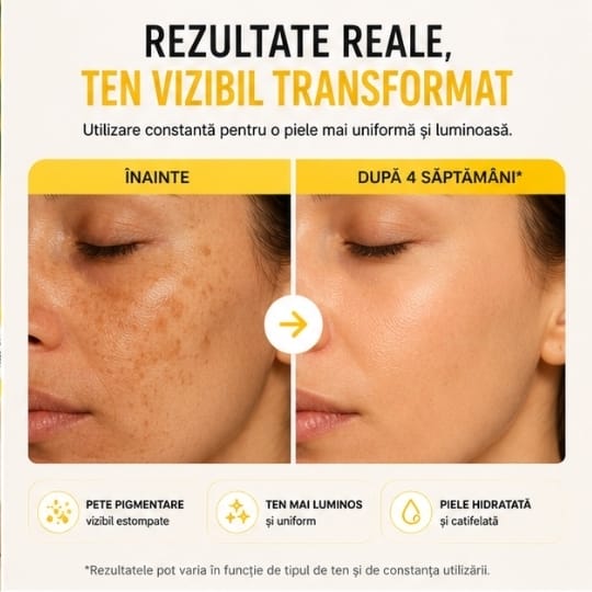Cremă pentru Pete Pigmentare și Uniformizarea Tenului | 100 g